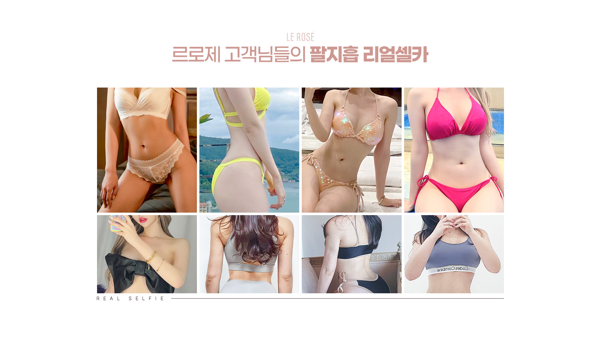 팔지방흡입 리얼셀카