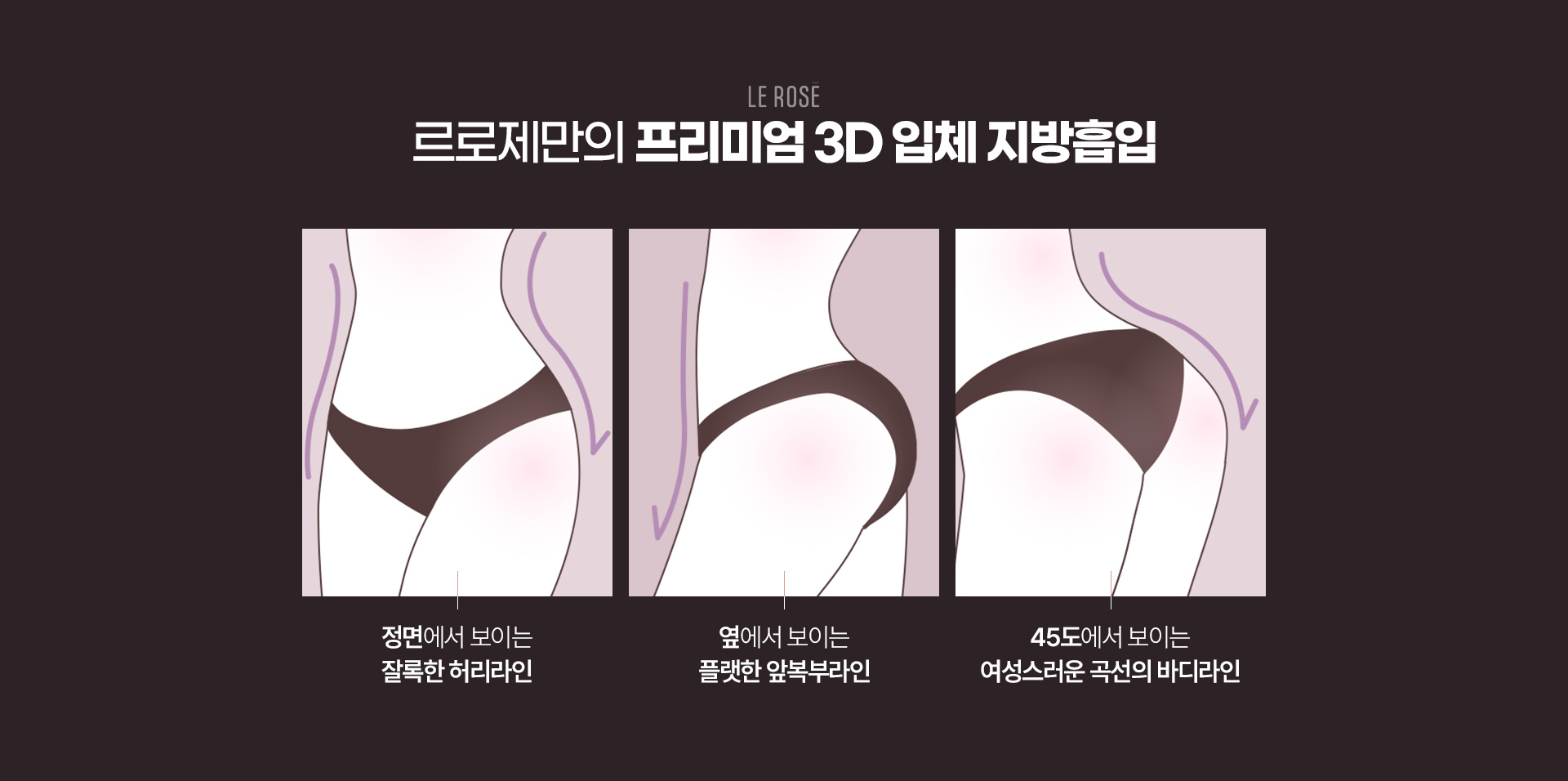 복부지방흡입 장점