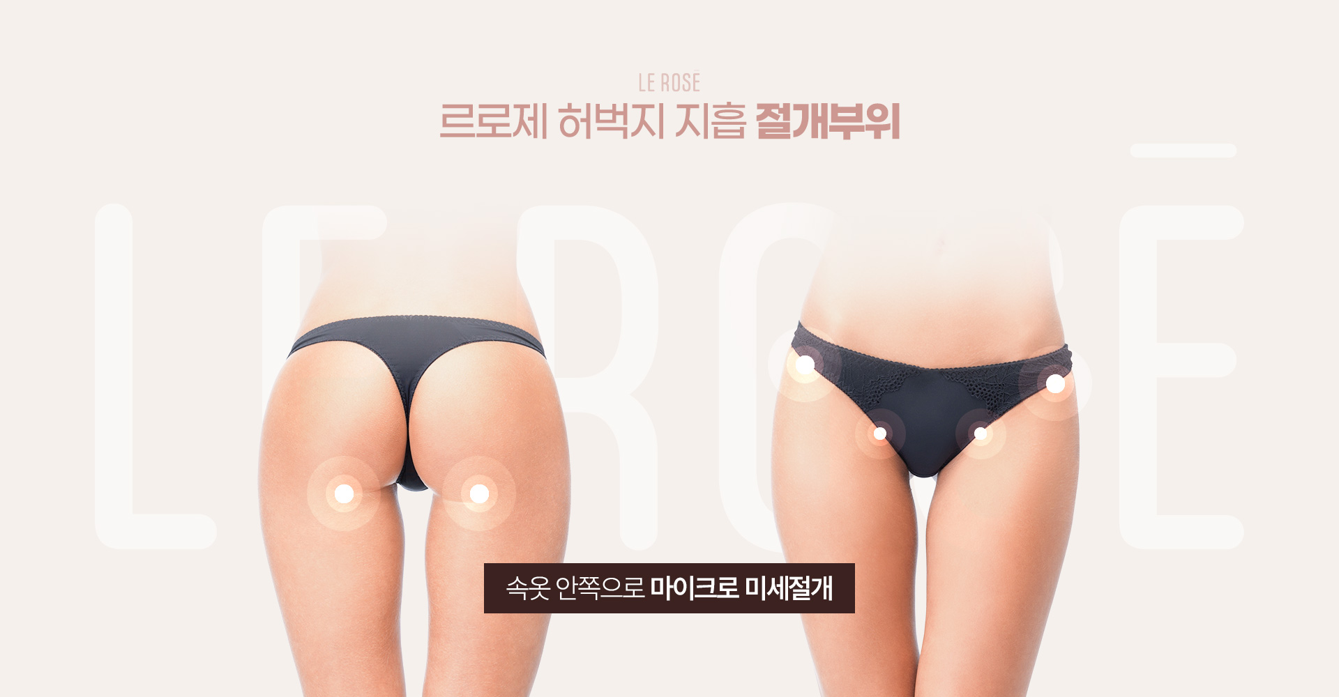 허벅지지방흡입 절개부위