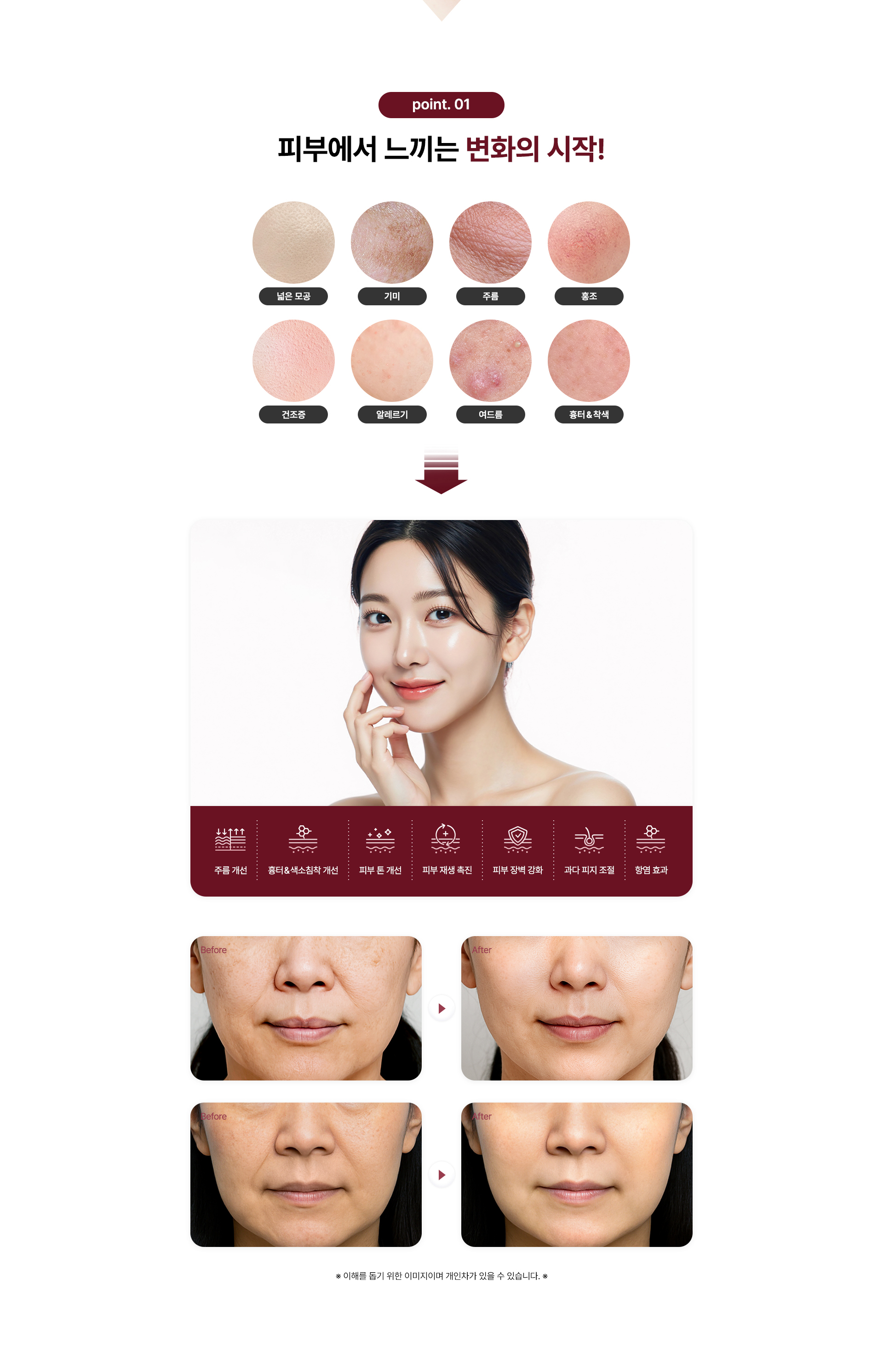 줄기세포 안티에이징