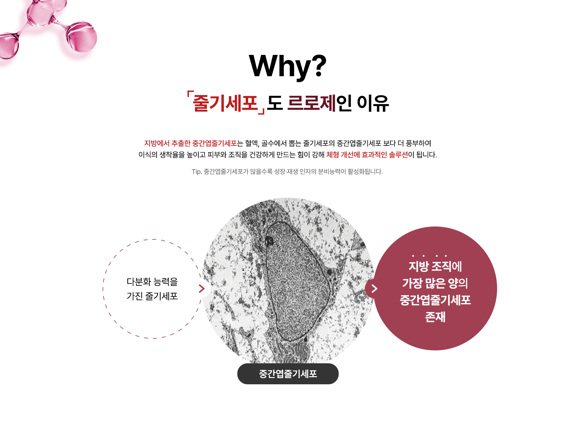 줄기세포 지방이식